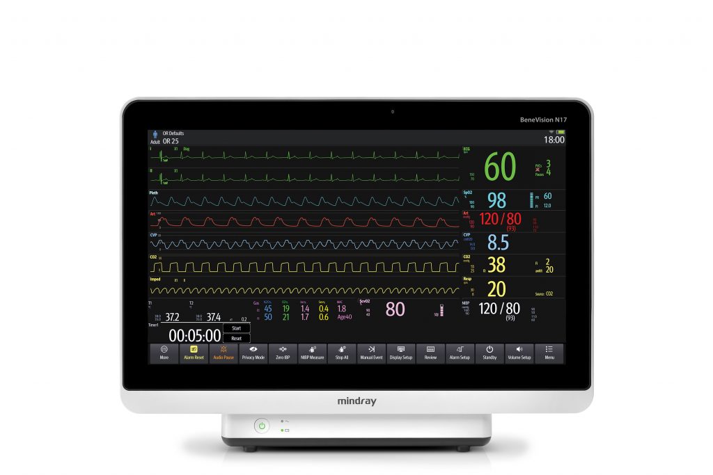 Patient monitor