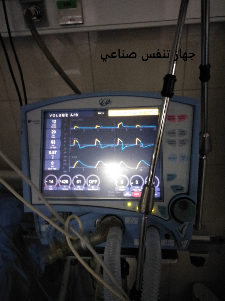 Ventilator