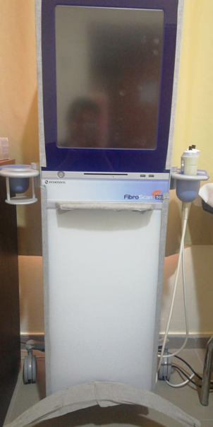 Fibroscan