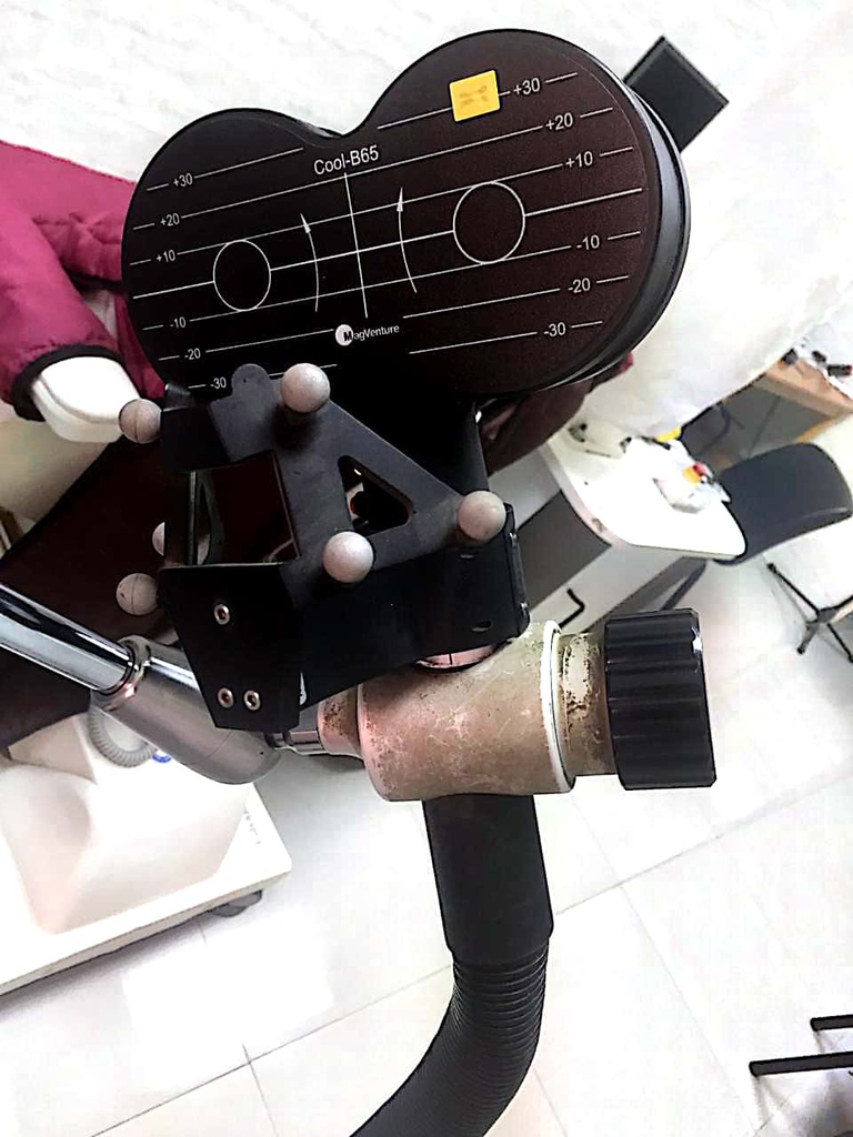 Transcranial magnatic stimulation