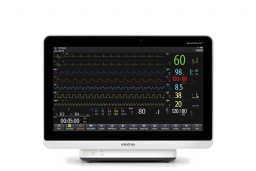 Patient monitor